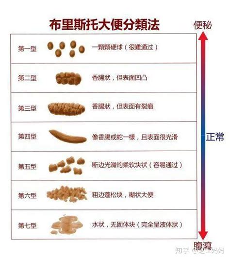 拉很多屎|每天拉一次屎才健康吗？你想多了！便便频率在这个范。